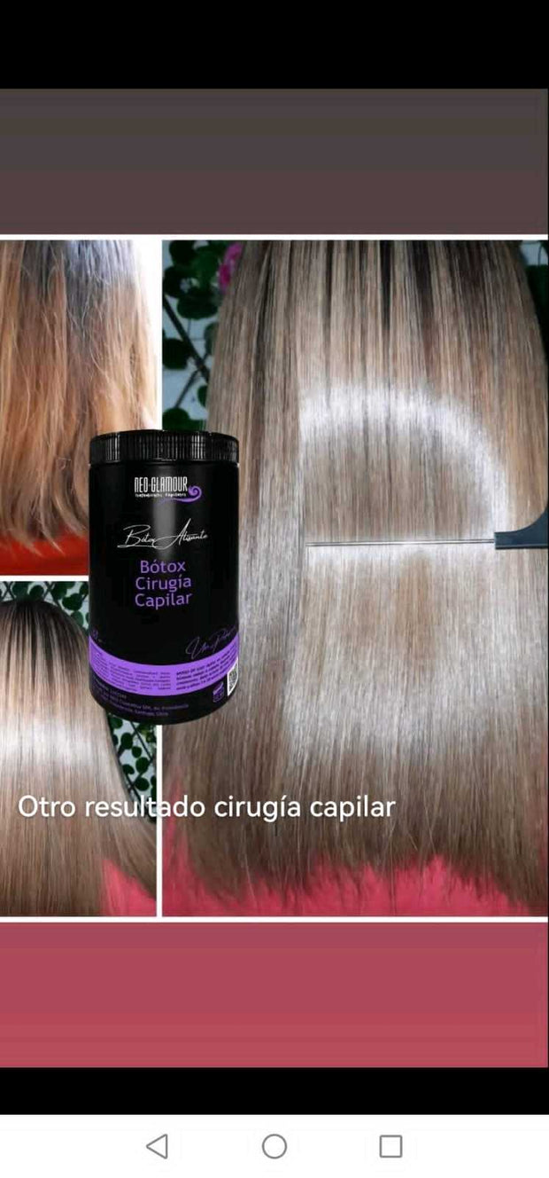 Botox Cirugia Capilar